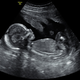 Illustration for article titled Gah! 3D Ultrasound Nightmare Fuel!